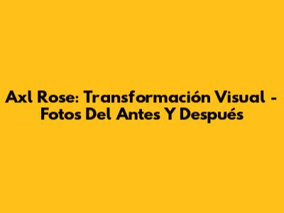 Axl Rose: Transformación Visual - Fotos Del Antes Y Después
